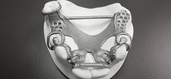 Пример печати на 3D принтере ProX 200 Dental